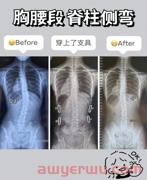 超全｜小红书薯条审核规则指南 第24张